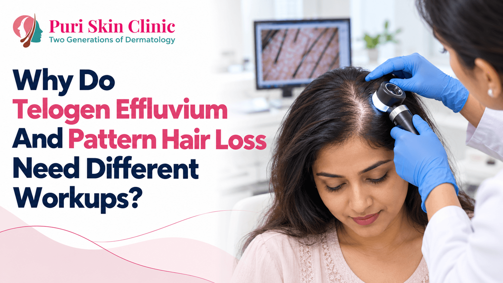 Why Do Telogen Effluvium And Pattern Hair Loss Need Different Workups?